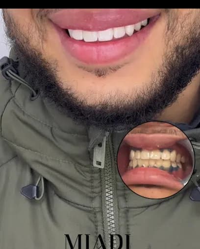 MIADI BEAUTY - Head Spa